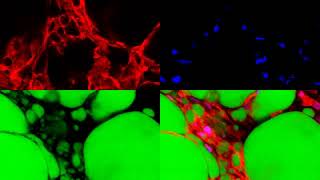 Innovative Technique Converts White Fat to Brown Fat [upl. by Doe]