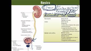 5 Pathology of obstructive uropathy and tumours [upl. by Tamberg]