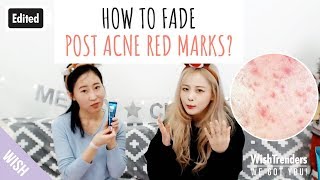 Edited How to Fade Post Acne Red Marks Post Acne Skin Care Tips  My Acne Story  WWGY [upl. by Jammie]