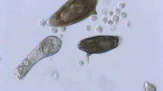 Schistosoma mansoni mother sporocyst and eggs [upl. by Alvy]