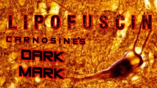 Lipofuscin Carnosines DARK MARK and a synergistic solution [upl. by Neiman326]