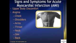 Signs and Symptoms for AMI Acute Myocardial Infarction [upl. by Remmus609]