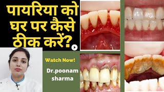 पायरिया को घर पर कैसे ठीक करेंpyorrhea ko thik karne ke gharelu upcharhome remedies for pyorrhea [upl. by Aurita]