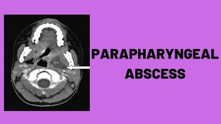 Nostril Abscess Drainage  Auburn Medical Group [upl. by Fifine]