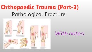 OrthopaedicTraumapart2 Pathological Fracture with notes [upl. by Wardle599]