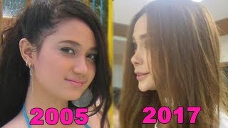 ARCI MUNOZ PLASTIC SURGERIES THROUGH THE YEARS [upl. by Wolfgang919]