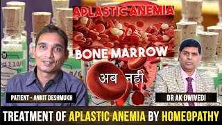 Aplastic anemia homeopathic treatment dr ak dwivedi ITP MDS low platelets amp hemoglobin bleeding [upl. by Nnyleak]