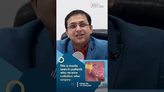 Facial Wounds After Buccal Mucosa Cancer Treatment Causes and Solutions  Dr Amit Chakraborty [upl. by Itsyrc]