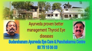 California Thyroid Graves ophthalmopathyAyurveda helped a lot  at Sudarshanam [upl. by Retswerb]