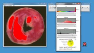 Using ImageJ to measure areas in histological samples [upl. by Eelannej924]