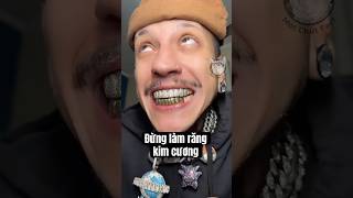 ĐỪNG LÀM RĂNG KIM CƯƠNG 😱 [upl. by Etheline]