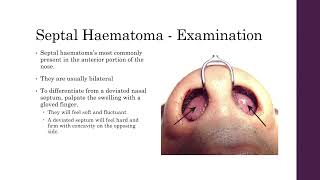 Septal Haematoma [upl. by Ettevroc]