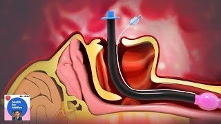 Difficult Airway Management  Airway Assessment  Intubation Anesthesiologist explains [upl. by Ilrahc274]