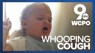 Sound of whooping cough [upl. by Morton]