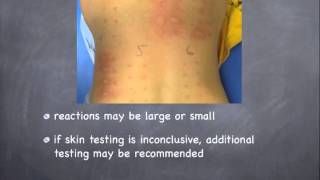 About Allergy Testing [upl. by Nylanej]