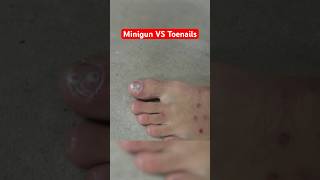 Removing my TOENAIL with a MINIGUN funny science comedy [upl. by Kipton949]