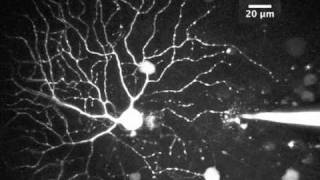 Two photon imaging in the PV retina [upl. by Aitnahs866]