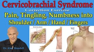 Cervicobrachial Syndrome Corrective Exercise Pain Burning into Shoulder Arm Hand  Dr Mandell [upl. by Henning305]