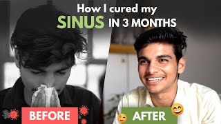 7Year Old Sinus Problem Gone in 3 Months  Sinus Treatment at Home [upl. by Korb293]