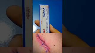 Ovidine Ointment  PovidoneIodine Ointment woundhealing viralvideo ytshorts health shorts [upl. by Osswald]