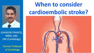 When to consider cardioembolic stroke [upl. by Clabo]