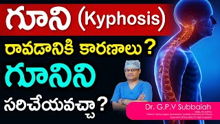 What is Kyphosis Can Kyphosis be corrected  I Kyphosis I scoliosis treatment I Dr GPV Subbaiah [upl. by Fiedling]