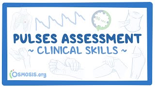 Clinical Skills Pulses assessment [upl. by Zemaj]