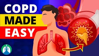 COPD Made Easy  Types Causes Symptoms and Treatment [upl. by Clausen]