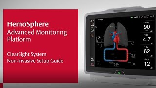 Noninvasive ClearSight System setup on the HemoSphere monitor [upl. by Nine]