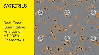 Chemotaxis Cell Migration and Invasion Assay [upl. by Margaux]