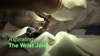 Wrist Joint Arthrocentesis [upl. by Porty306]