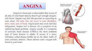 Angina Pectoris  Complete Details of Angina Pectoris  What is Angina  Antianginal Drugs [upl. by Neenaj]