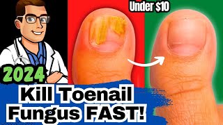 1 NEW Best Toenail Fungus Treatments Medications vs Creams vs Laser [upl. by Leuqer]