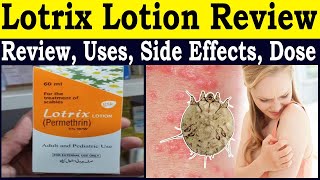 Permethrin 5 Lotion How To Use  lotrix lotion uses in urdu  permethrin lotion kaise use kare [upl. by Enomahs]