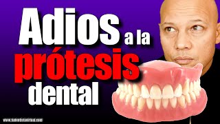 LA MEJOR FORMA de REEMPLAZAR TU PROTESIS DENTAL sin TENER MUCHO HUESO en las ENCÍAS [upl. by Eelegna557]