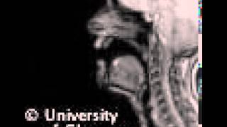 MRI voiced palatal lateralapproximant [upl. by Jewelle]