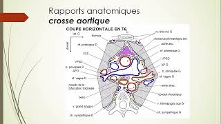 7  Aorte et Artère pulmonaire 3 [upl. by Aden]