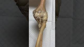 Elbow Joint [upl. by Salita]