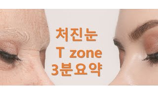 T zone 눈처짐 3분 요약  제이제이성형외과 [upl. by Htezil]