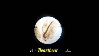 Daphnia🪲🪲 Heart beat 💓💗  Zooplankton  Under Microscope 🔬🔬 Water fleas 🪲 [upl. by Lugar131]