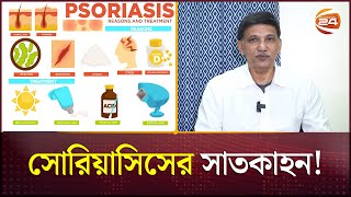 সোরিয়াসিসের সাতকাহন  Psoriasis  Health and Cure  Channel 24 [upl. by Sibby219]