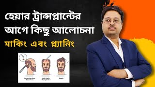 হেয়ার ট্রান্সপ্লান্ট নিয়ে আলোচনা  মাকিং এবং প্ল্যানিং  Dr Jayanta Bain plastic surgeon [upl. by Hsirehc166]