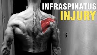 Shoulder Lat Tricep Rotator Cuff Pain  Infraspinatus [upl. by Tremain330]