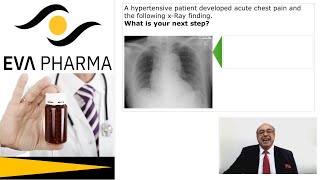 cme internalmedicine Medicine usmle Hypertension  Acute Chest Pain Answer محاضراتباطنة [upl. by Pooi101]