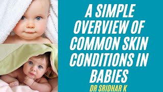 Skin rash ll Simple overview of common skin conditions in babies [upl. by Eam]