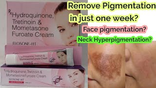 ELOSONEHT Triple Action Face Pigmentation Removal Cream Review ll beauty sight ll [upl. by Elimay599]