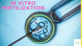 In vitro fertilization IVF Procedure amp How It Works [upl. by Nnylyrehc]