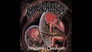 Malignancy  Intrauterine Cannibalism Full Album [upl. by Madelle598]