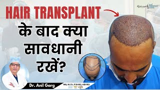 10 सावधानियां जो आपको जाननी चाहिए Hair Transplant के बाद  Care after Hair Transplant [upl. by Nwahsar64]