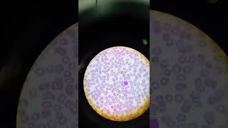 Myeloblast cells microscope shorts trending [upl. by Atse113]